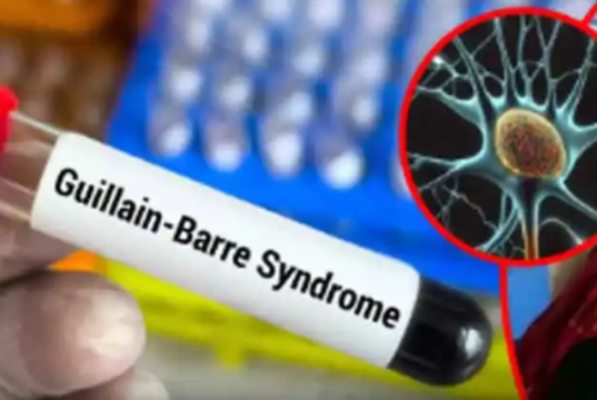 महाराष्ट्रात गिलियन-बारे सिंड्रोमचा धोका वाढला! पुण्यात आणखी ५ रुग्ण आढळले, मृतांचा आकडा ५ वर